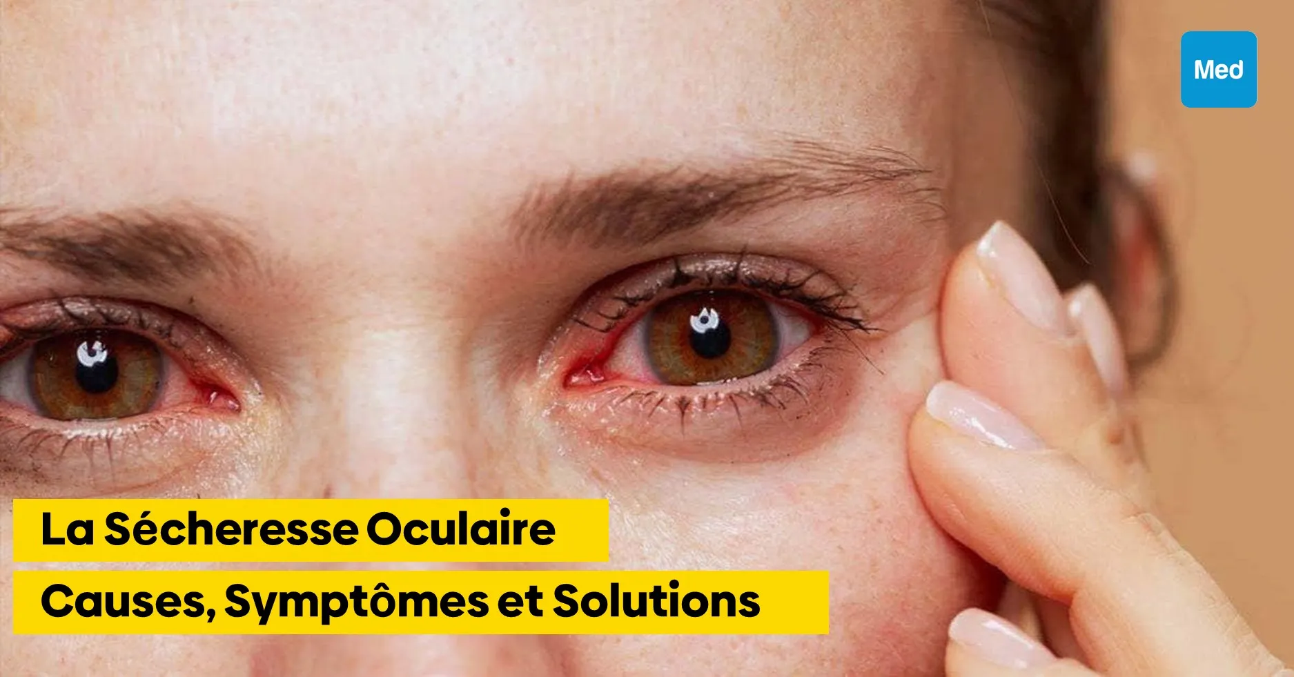 La Sécheresse Oculaire : Causes, Symptômes et Solutions